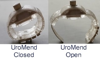 UroMend Incontinence Control Device UM1001