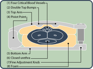 Anatomy illustration showing the effects of the Squeezer Klip on the penis 